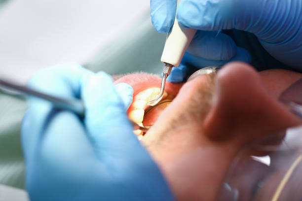Best Emergency Treatment for Toothache in Gretna, FL